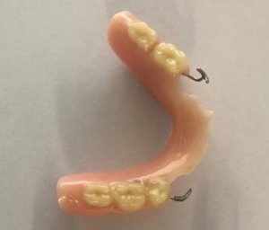A Partial Lower Acrylic Denture with 5 artificial back molar teeth and metal clasps to hook onto your natural teeth to hold it in